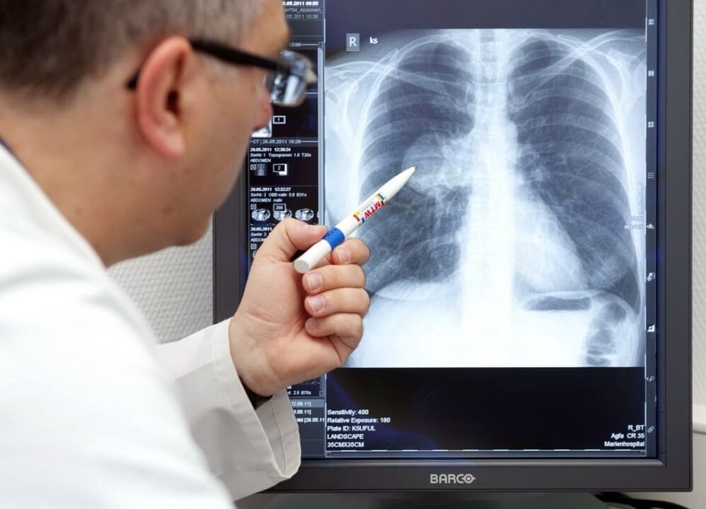 dijagnoza arterijske hipertenzije